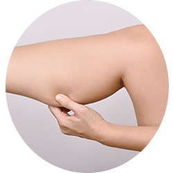 Dr Braun Body Procedures - Calf Augmentation