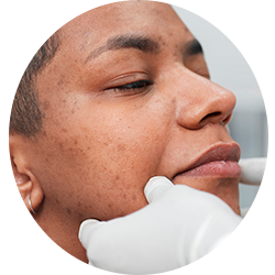 Face Surgery Procedures - Cheek Reduction