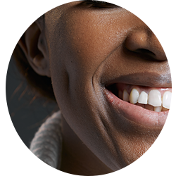 Face Surgery Procedures - Dimples
