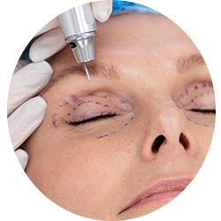 Face Surgery Procedures - Eyelid Surgery