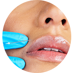 Face Surgery Procedures - Lip Augmentation