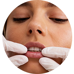 Face Surgery Procedures - Lip Reduction