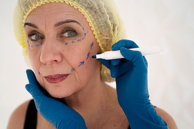 Dr Braun FaceLift Surgery