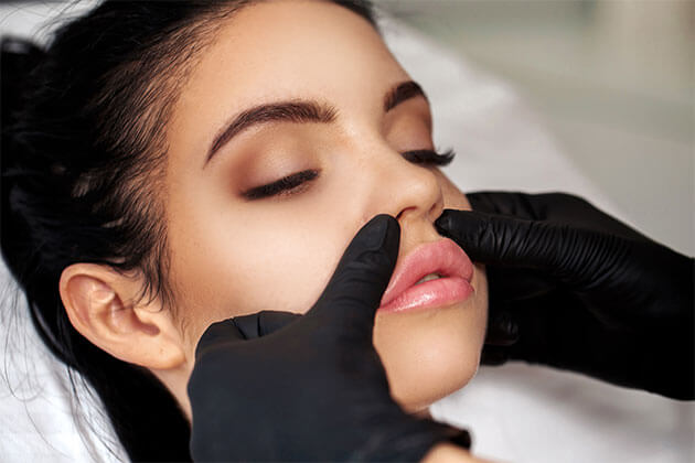 Upper Lip Lift